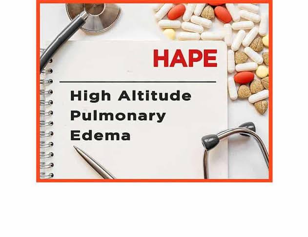 HIGH ALTITUDE PULMONARY EDEMA (HAPE) ON MOUNT KILIMANJARO